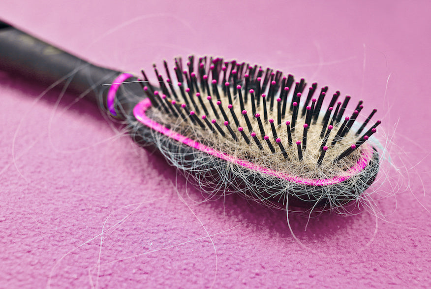 Is Your Hair Loss Normal or a Case of Alopecia?