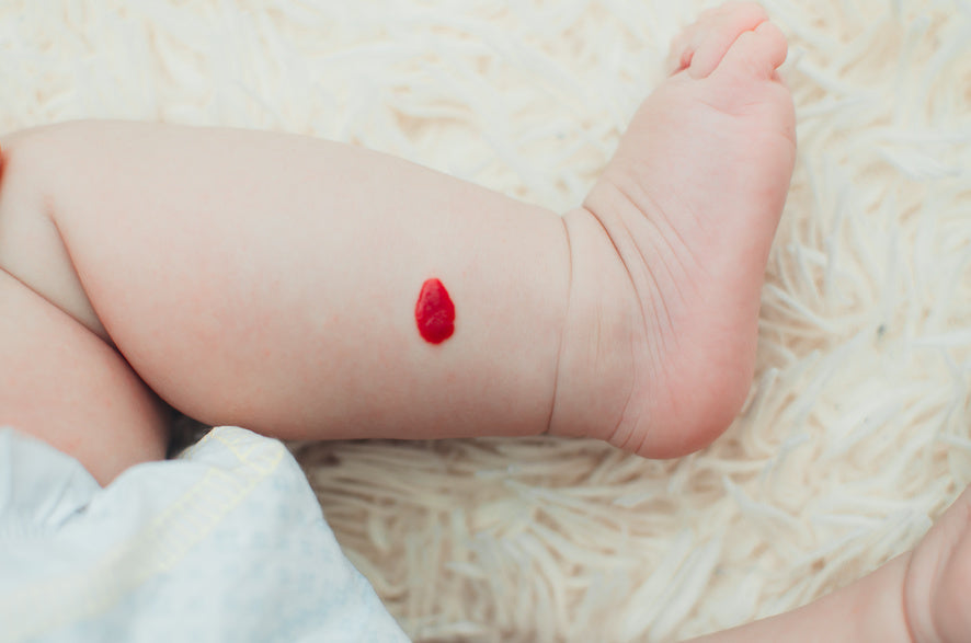 Seeing Spots? Here’s the Deal With Those Bright Red Angiomas